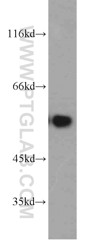 Western Blot (WB) analysis of human brain tissue using PPP3CC-specific Polyclonal antibody (55163-1-AP)