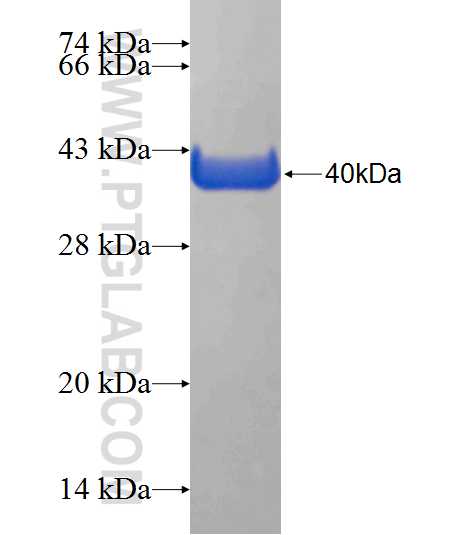 419cn fusion protein Ag24301 SDS-PAGE