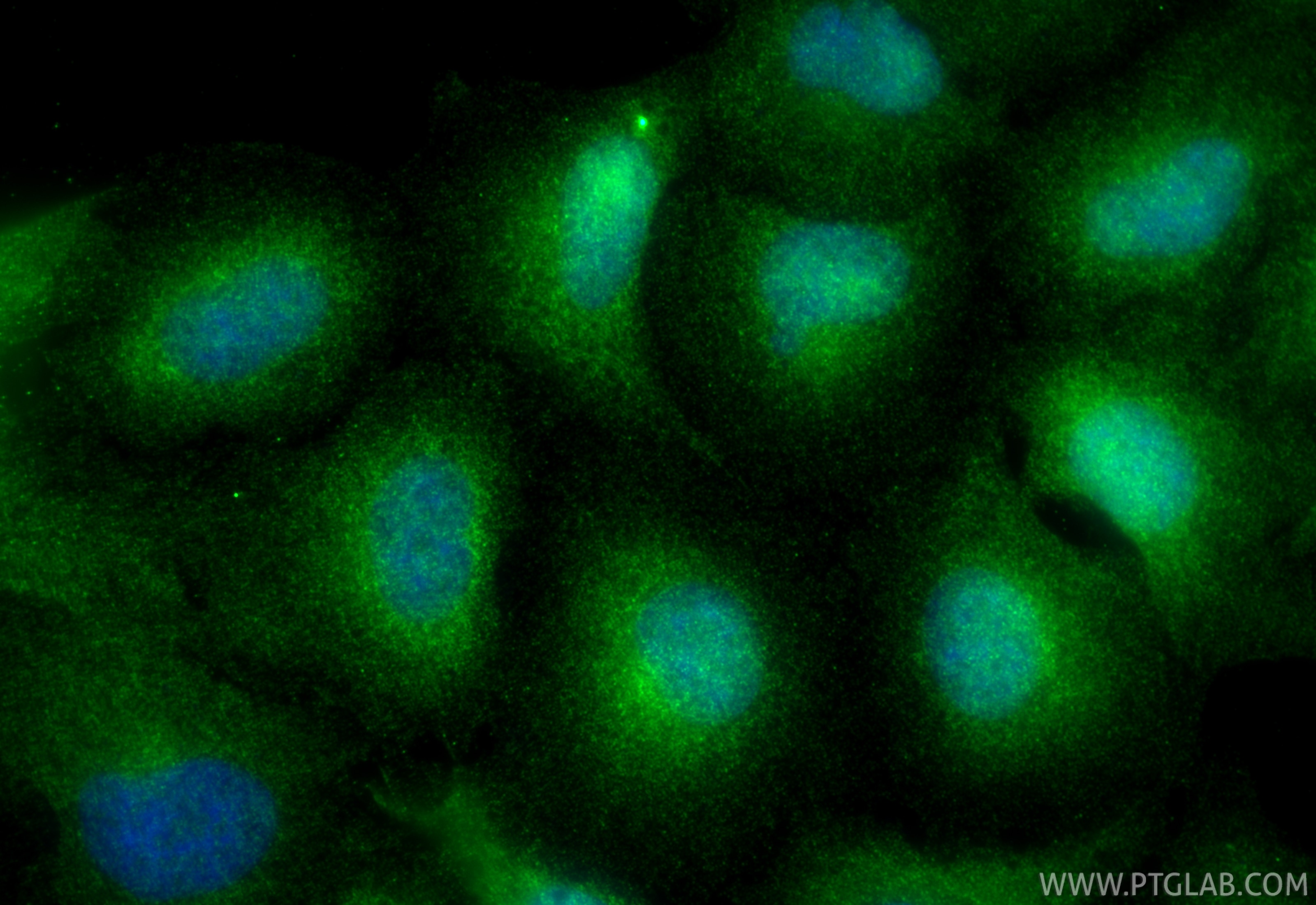 Immunofluorescence (IF) / fluorescent staining of A549 cells using 4EBP1 Polyclonal antibody (13988-1-AP)