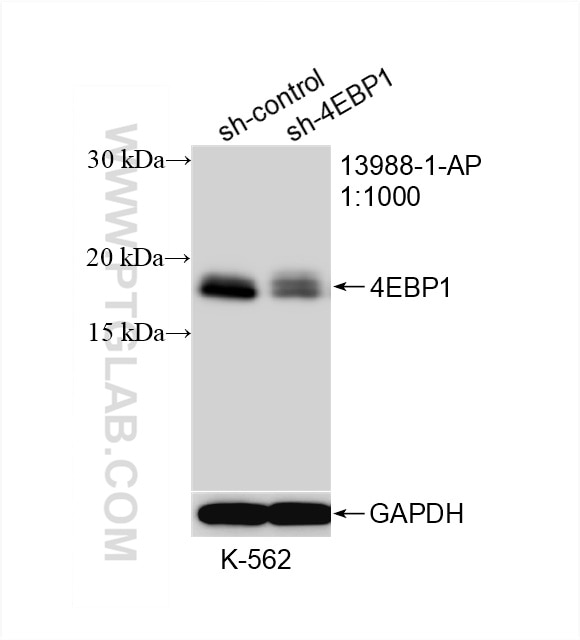 Western Blot (WB) analysis of K-562 cells using 4EBP1 Polyclonal antibody (13988-1-AP)