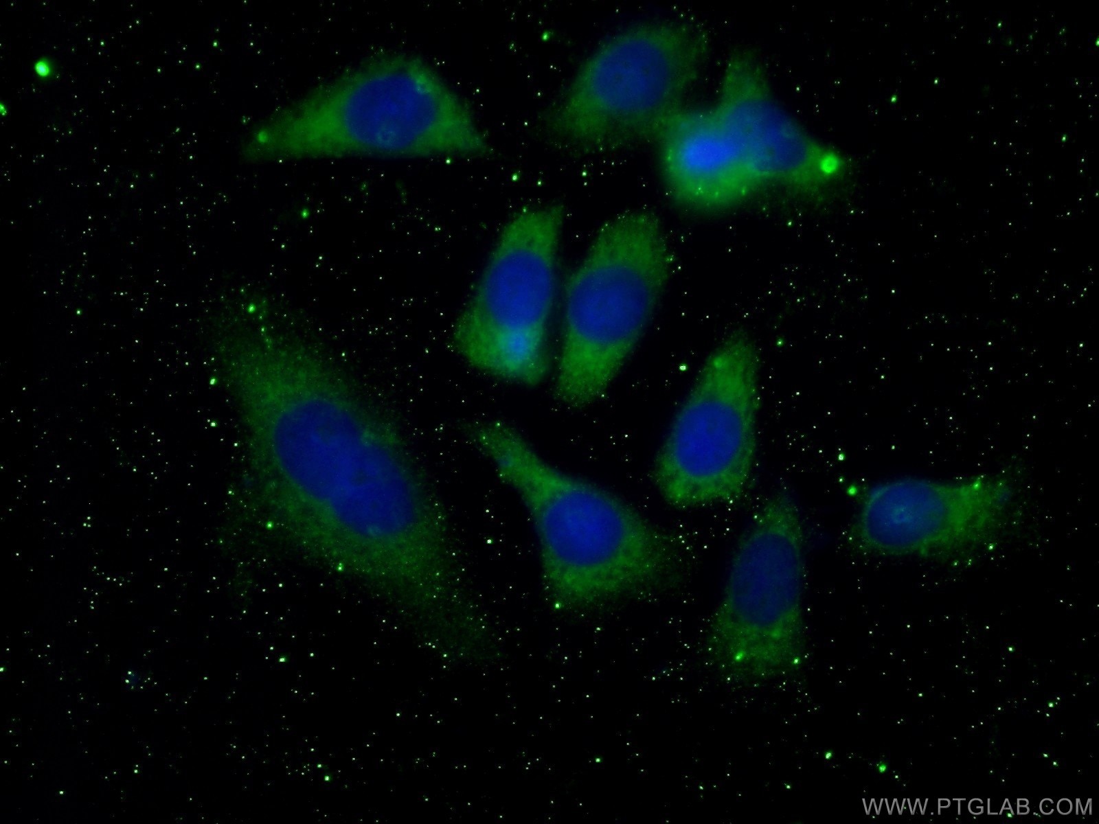 Immunofluorescence (IF) / fluorescent staining of HeLa cells using 4EBP1 Monoclonal antibody (60246-1-Ig)