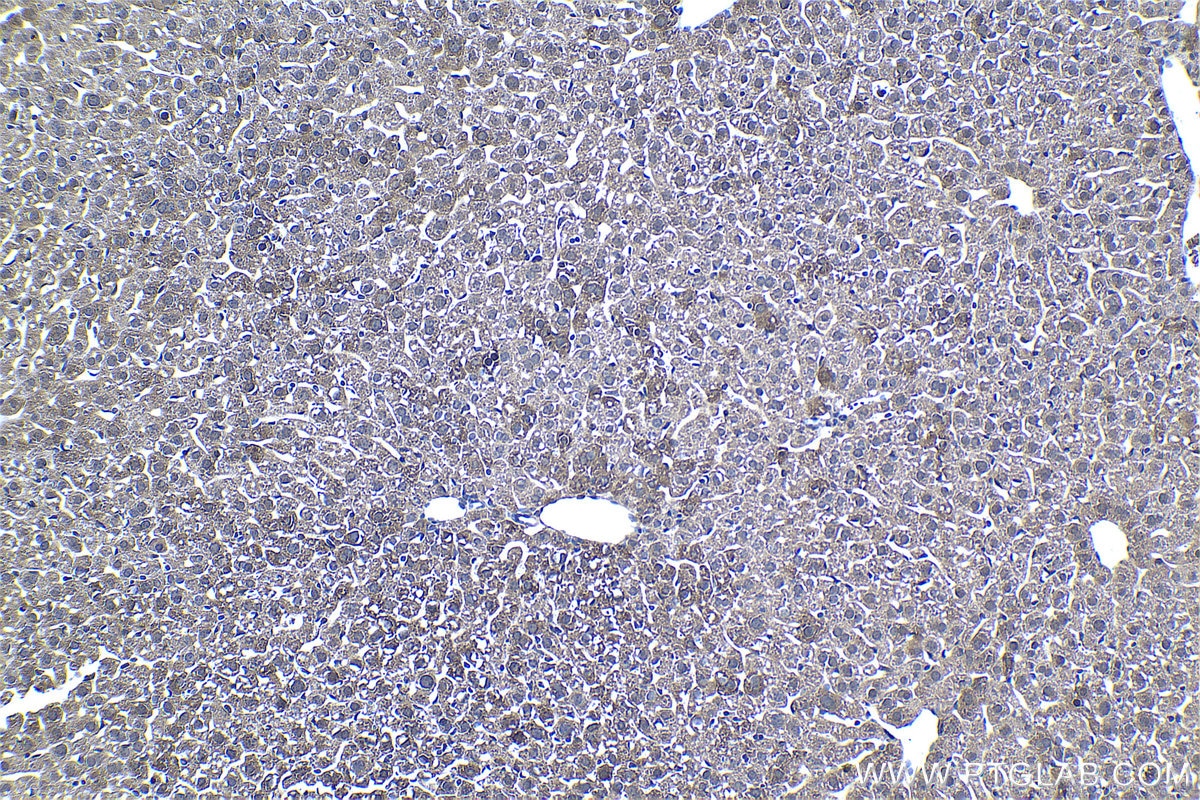 Immunohistochemistry (IHC) staining of mouse liver tissue using 4EBP1 Monoclonal antibody (60246-1-Ig)