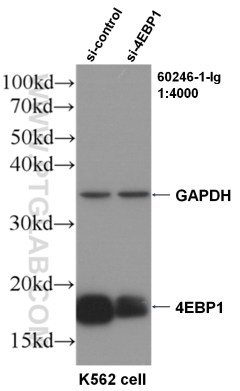 Western Blot (WB) analysis of K562 using 4EBP1 Monoclonal antibody (60246-1-Ig)
