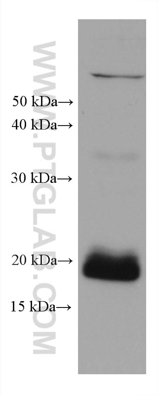 Western Blot (WB) analysis of NCI-H1299 cells using 4EBP1 Monoclonal antibody (60246-1-Ig)