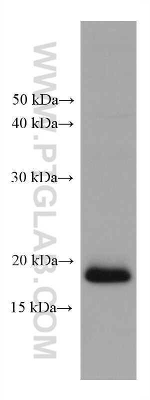 Western Blot (WB) analysis of HCT 116 cells using 4EBP1 Monoclonal antibody (60246-1-Ig)