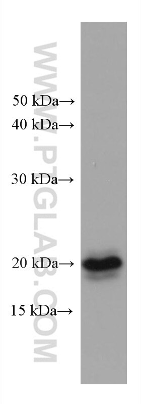 Western Blot (WB) analysis of C6 cells using 4EBP1 Monoclonal antibody (60246-1-Ig)