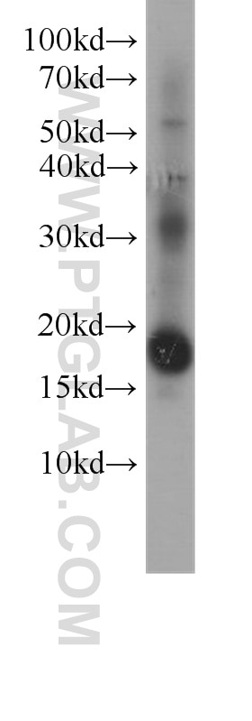Western Blot (WB) analysis of K-562 cells using 4EBP1 Monoclonal antibody (60246-1-Ig)