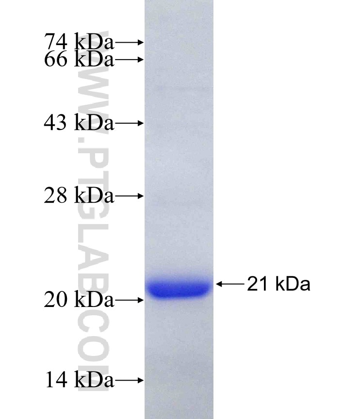 4EBP1 fusion protein Ag18985 SDS-PAGE