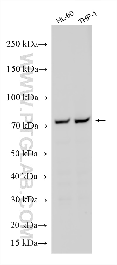 Western Blot (WB) analysis of various lysates using Multi-rAb® 5 Lipoxygenase Multi-Recombinant antibo (RMX00080)