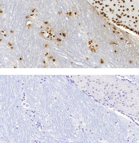 5-Methylcytosine (5-mc) antibody (pAb) tested by Immunohistochemistry Punctate nuclear staining pattern is detected in Formalin-fixed, paraffin-embedded tissue sections from human substantia nigra (midbrain). Top Panel: 5-mC antibody at 1:1000 dilution. Bottom Panel: No primary antibody (2nd step antibody alone)