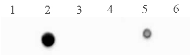 5-Methylcytosine (5-mC) antibody (mAb) tested by dot blot analysis. DNA from the Methylated DNA Standard Kit (Catalog No. 55008) were spotted (5 ng per spot) on to a positively charged nylon membrane and blotted with 5-Methylcytosine antibody (2 ug/ml dilution). Lane 1: single-stranded unmethylated DNA. Lane 2: single-stranded DNA containing 5-methylcytosine. Lane 3: single-stranded DNA containing 5-hydroxymethylcytosine. Lane 4: double-stranded unmethylated DNA. Lane 5: double-stranded DNA containing 5-methylcytosine. Lane 6: double-stranded DNA 5-hydroxymethylcytosine.