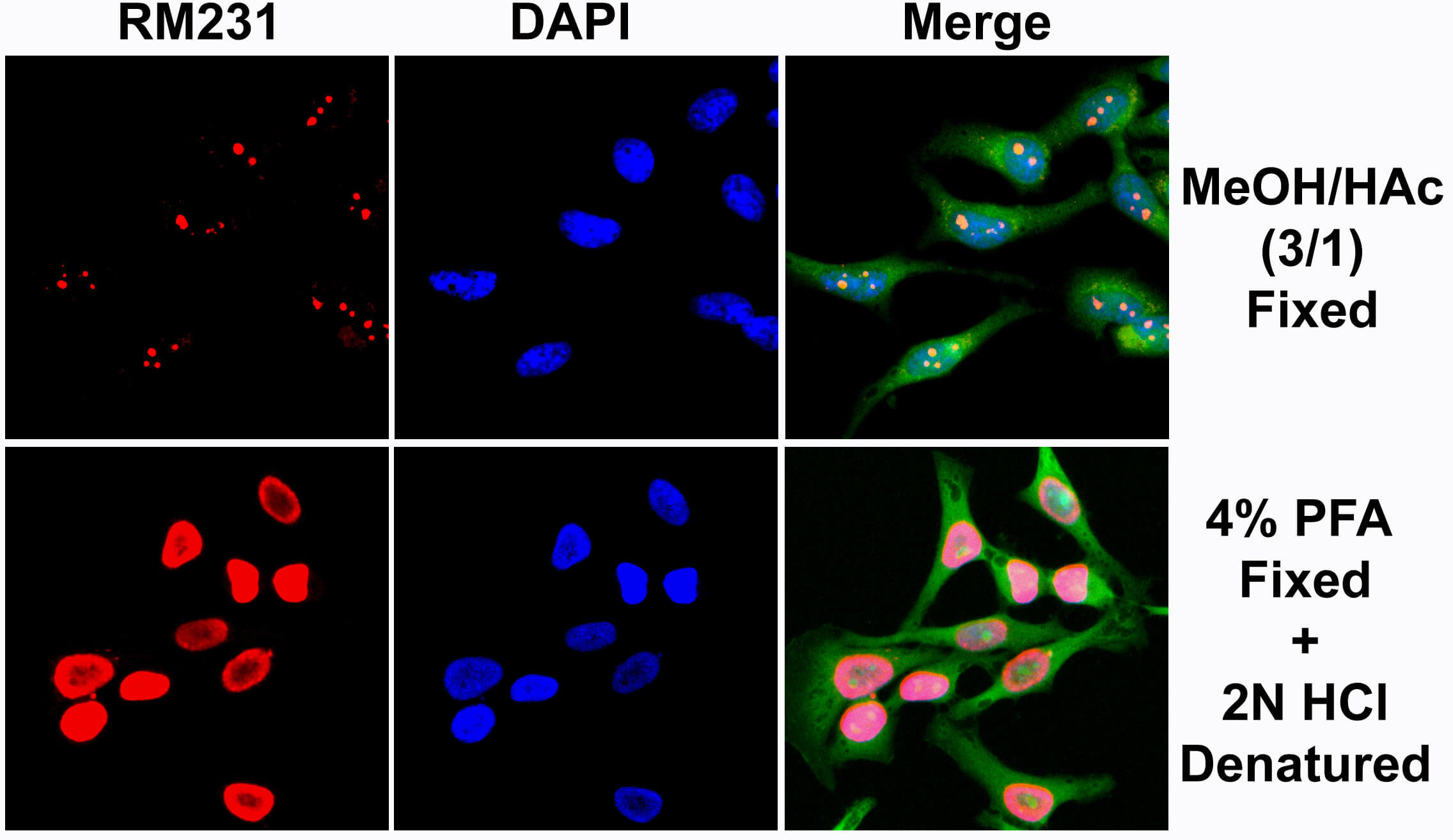 Immunofluorescence stain of 5-Methylcytosine (5-mC) antibody (rAb).HeLa cells were stained using 5-Methylcytosine (5-mC) antibody (RM231) antibody at 1 ug/ml (red). Actin filaments have been labeled with fluorescein phalloidin (green), and nuclei stained with DAPI (blue).