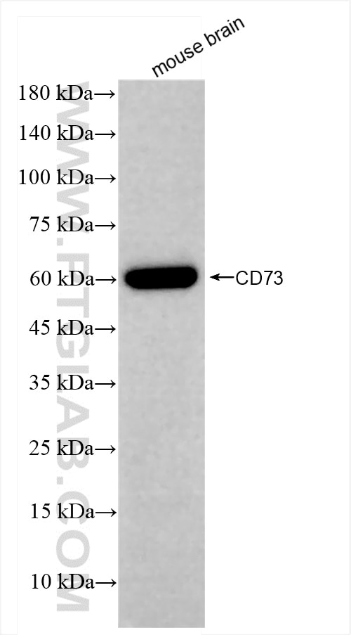 Western Blot (WB) analysis of mouse brain tissue using 5'-Nucleotidase/CD73 Recombinant antibody (84434-4-RR)