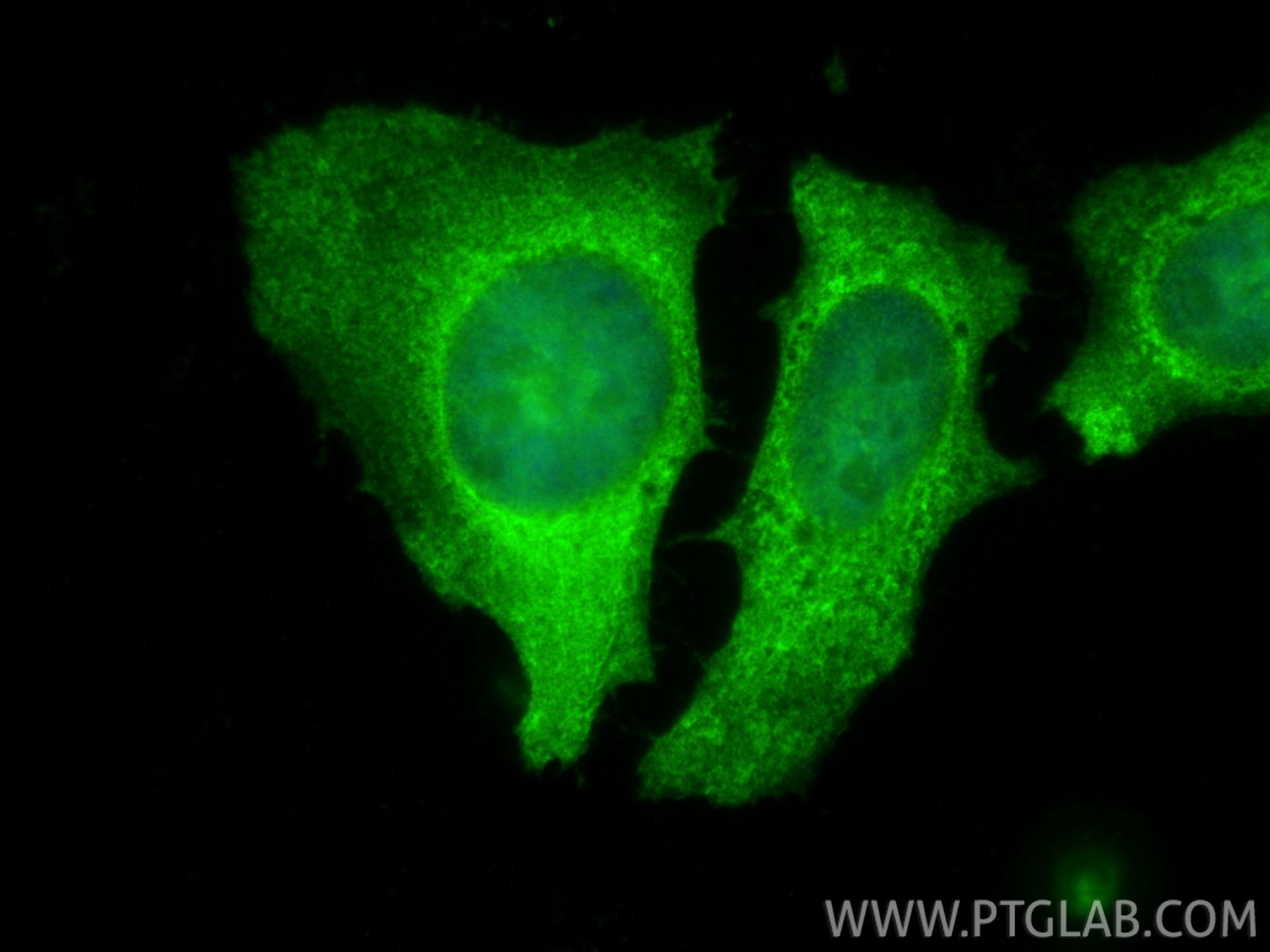 Immunofluorescence (IF) / fluorescent staining of HeLa cells using 53BP2 Polyclonal antibody (26550-1-AP)
