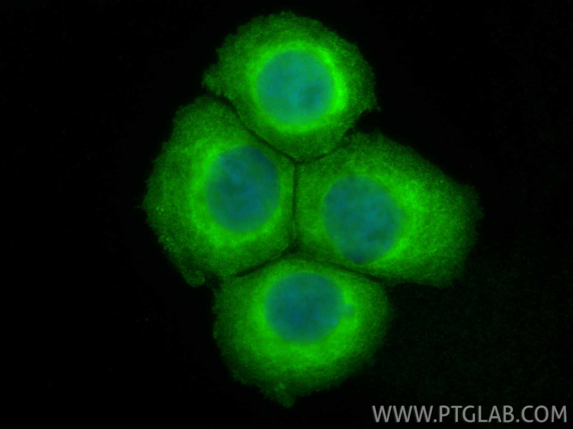 Immunofluorescence (IF) / fluorescent staining of MCF-7 cells using 53BP2 Polyclonal antibody (26550-1-AP)