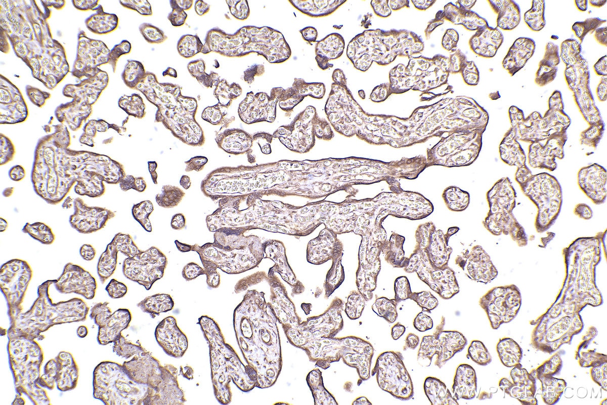 Immunohistochemistry (IHC) staining of human placenta tissue using 53BP2 Polyclonal antibody (26550-1-AP)