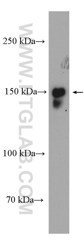 Western Blot (WB) analysis of MCF-7 cells using 53BP2 Polyclonal antibody (26550-1-AP)