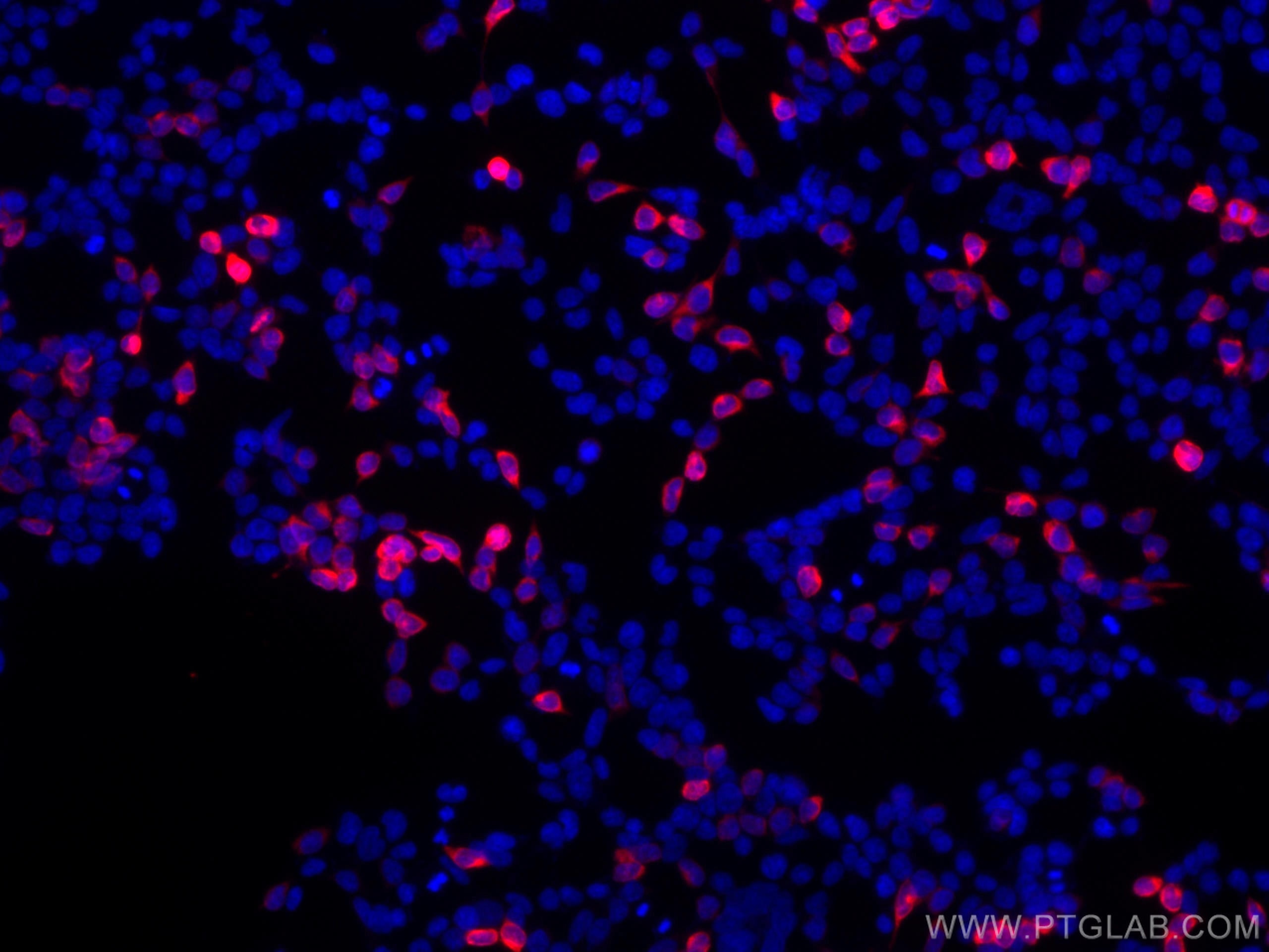 Immunofluorescence (IF) / fluorescent staining of Transfected HEK-293 cells using CoraLite®594-conjugated 6*His, His-Tag Monoclonal  (CL594-66005)