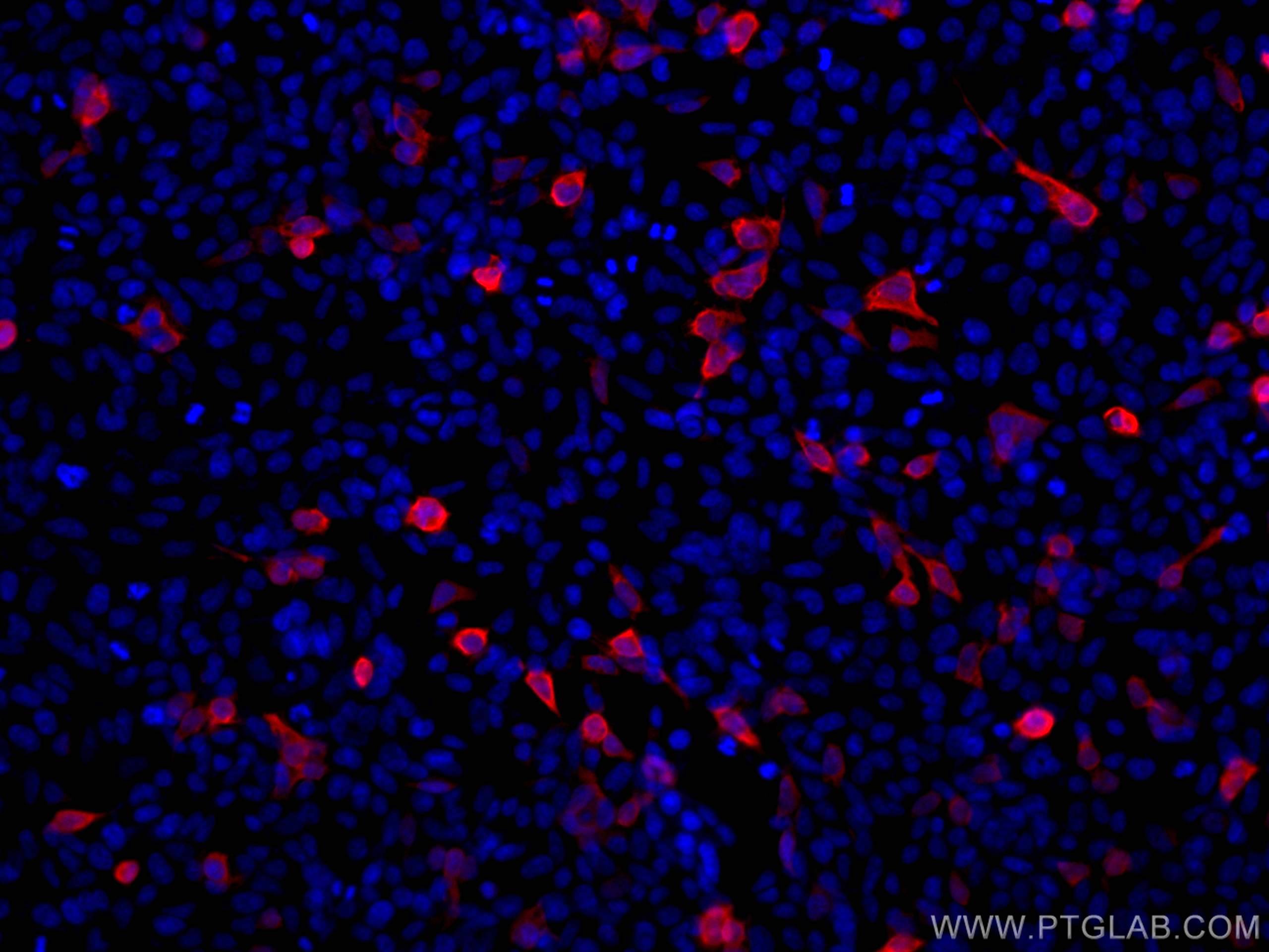 Immunofluorescence (IF) / fluorescent staining of Transfected HEK-293 cells using CoraLite® Plus 647-conjugated 6*His, His-Tag Monoc (CL647-66005)