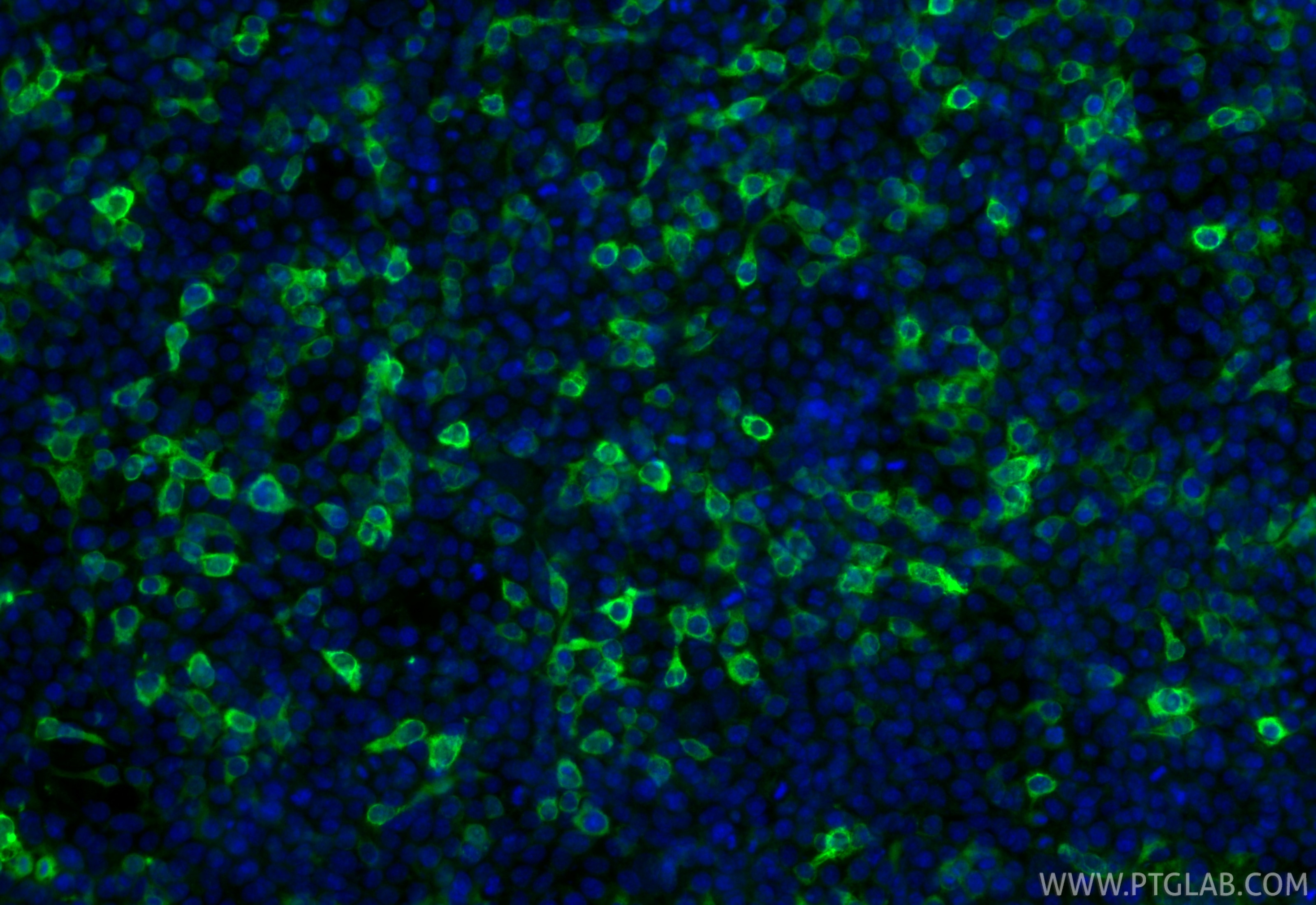 IF Staining of Transfected HEK-293 using 10001-0-AP Immunofluorescence (IF) / fluorescent staining of Transfected HEK-293 cells using 6*His, His-tag Polyclonal antibody (10001-0-AP)