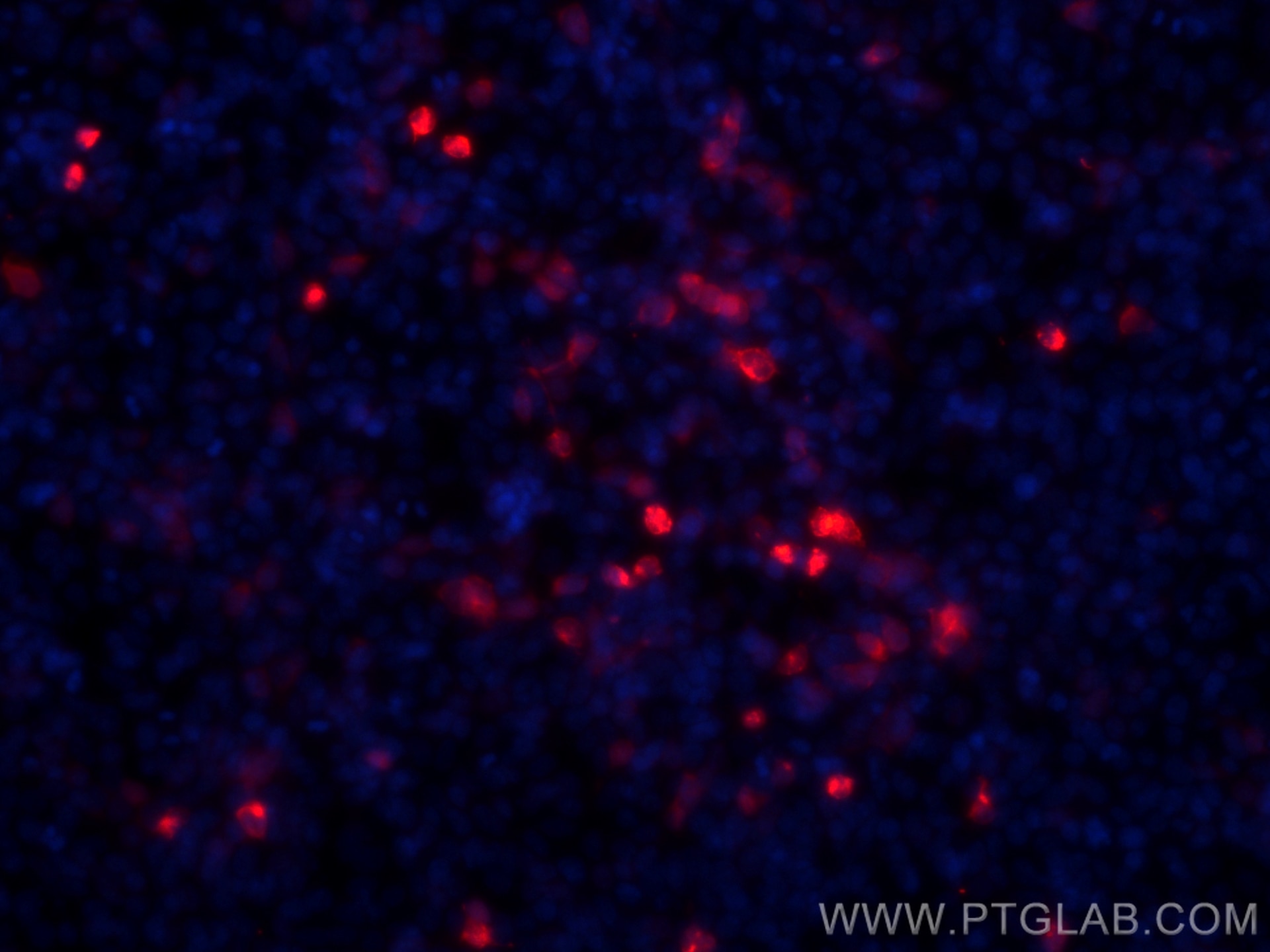 Immunofluorescence (IF) / fluorescent staining of Transfected HEK-293 cells using CoraLite®594-conjugated 6*his,His tag Recombinant  (CL594-84814)