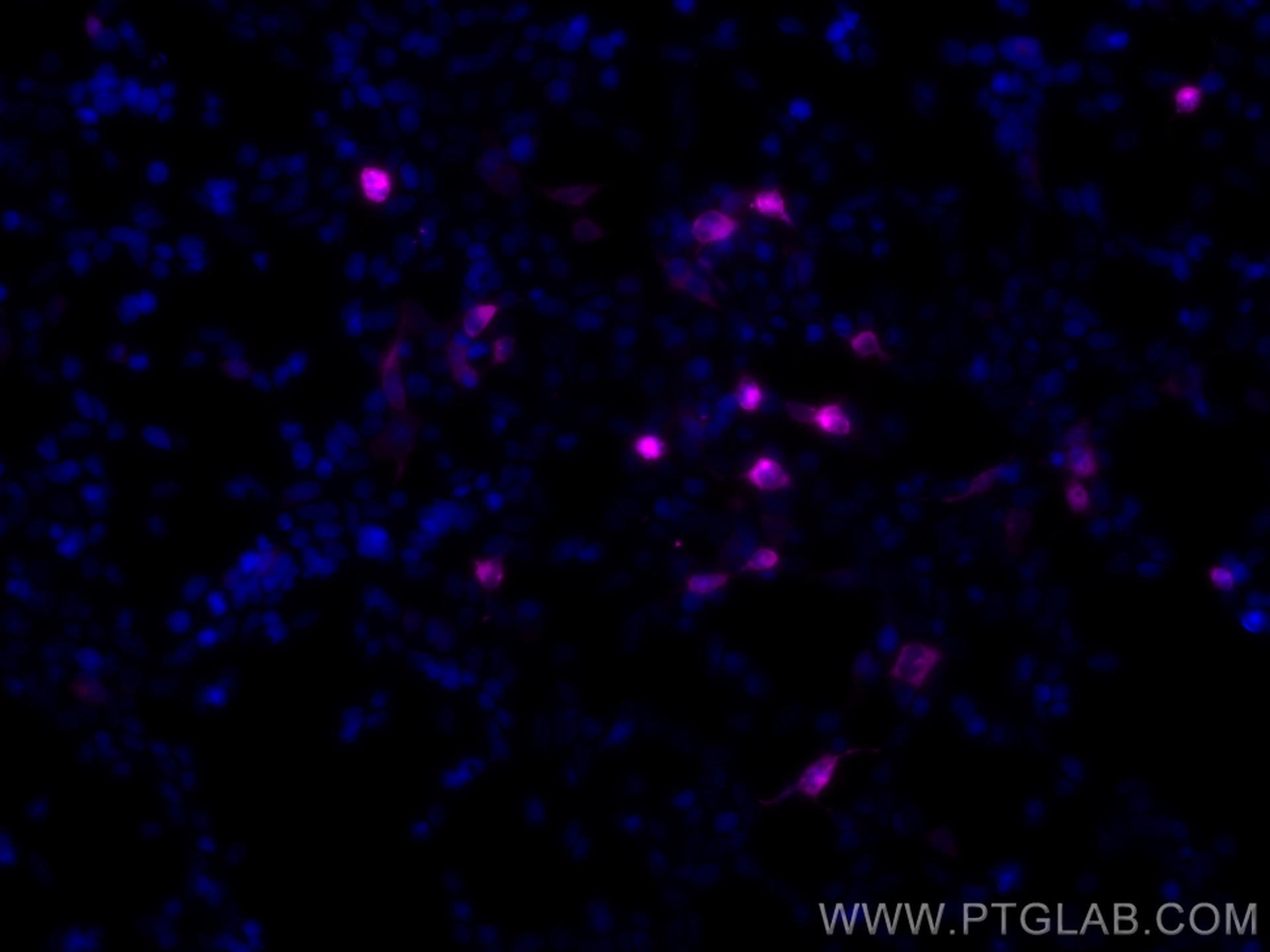 Immunofluorescence (IF) / fluorescent staining of Transfected HEK-293 cells using CoraLite® Plus 647-conjugated 6*his,His tag Recomb (CL647-84814)