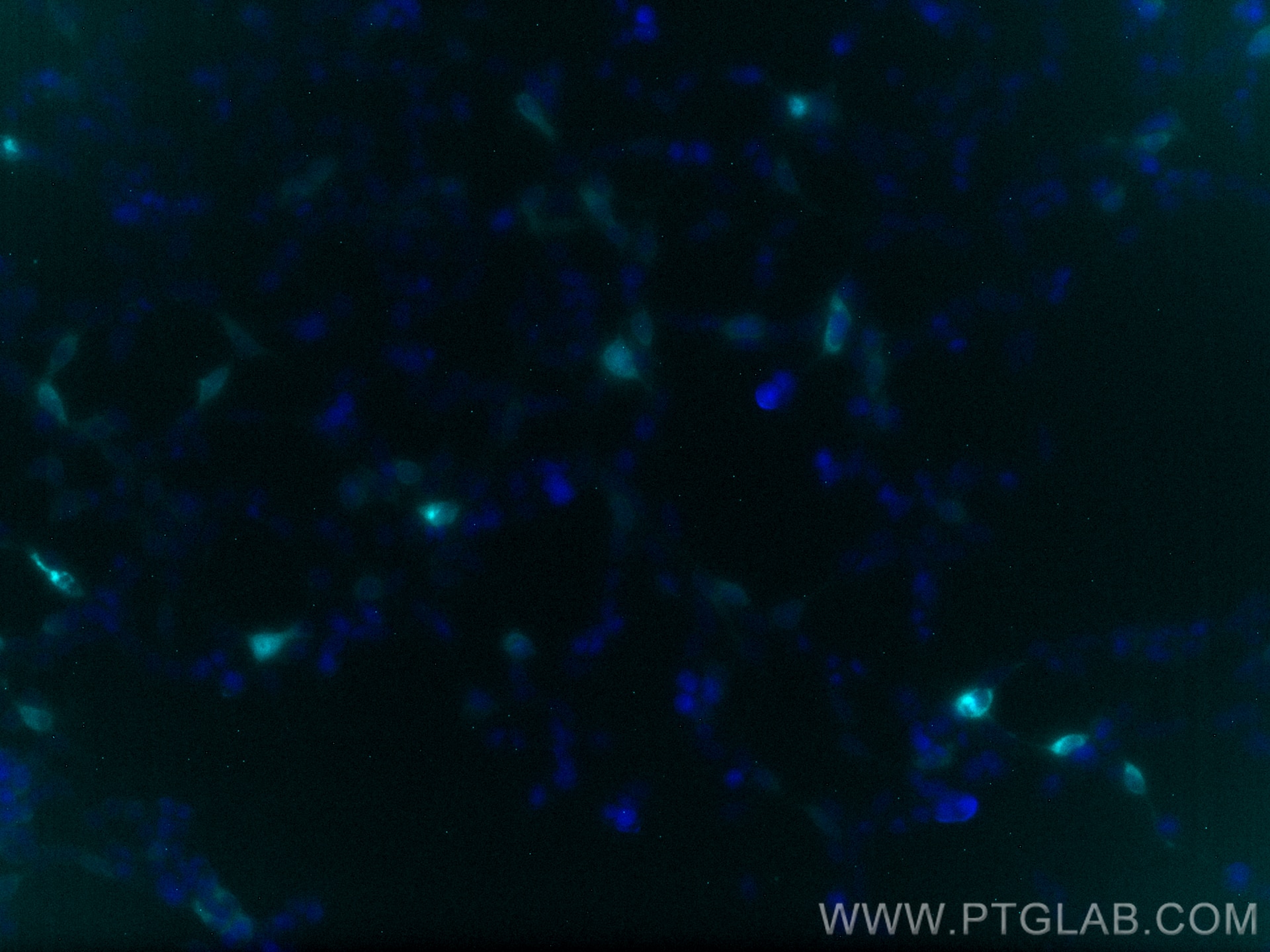 Immunofluorescence (IF) / fluorescent staining of Transfected HEK-293 cells using CoraLite® Plus 750-conjugated 6*his,His tag Recomb (CL750-84814)