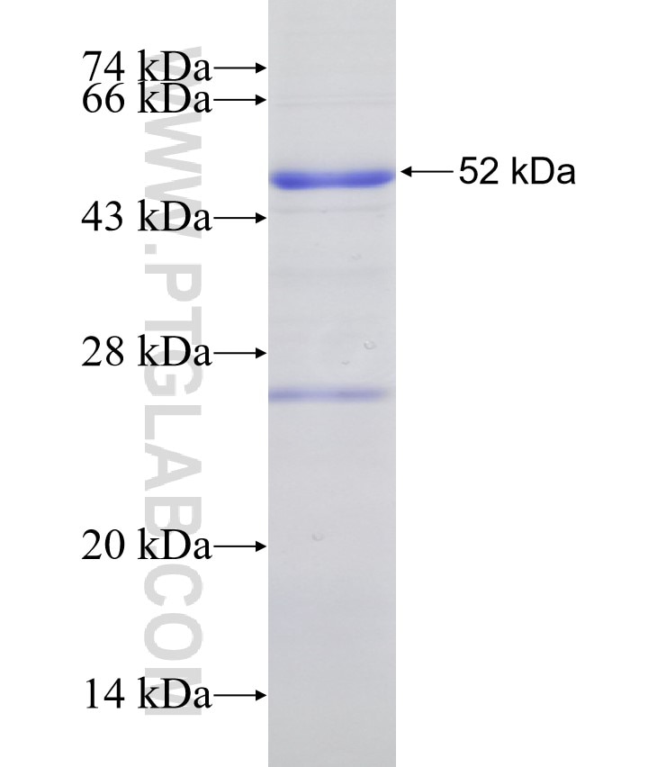 705CN fusion protein Ag31612 SDS-PAGE