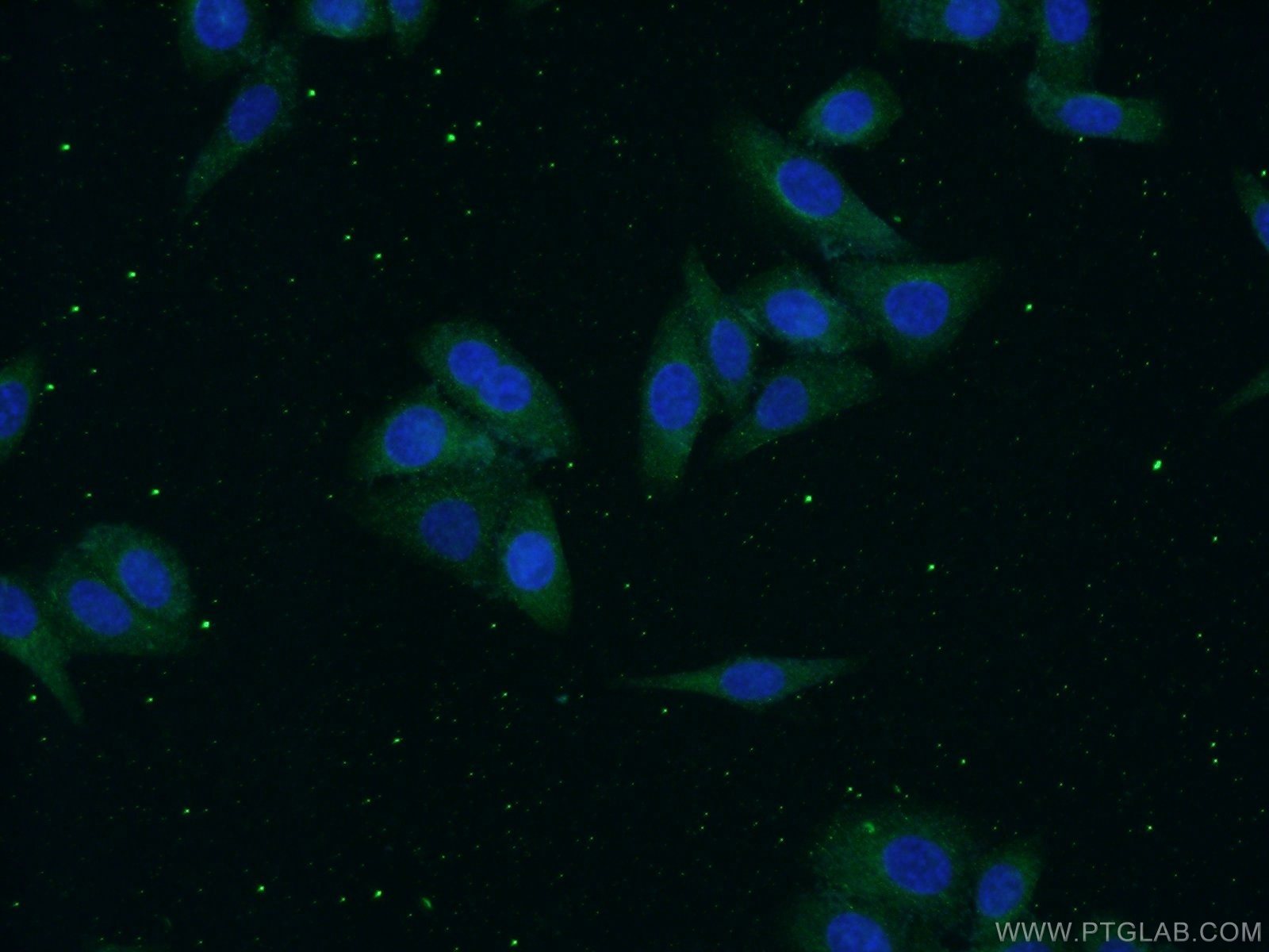 Immunofluorescence (IF) / fluorescent staining of HepG2 cells using Alpha 1B-Glycoprotein Polyclonal antibody (14181-1-AP)