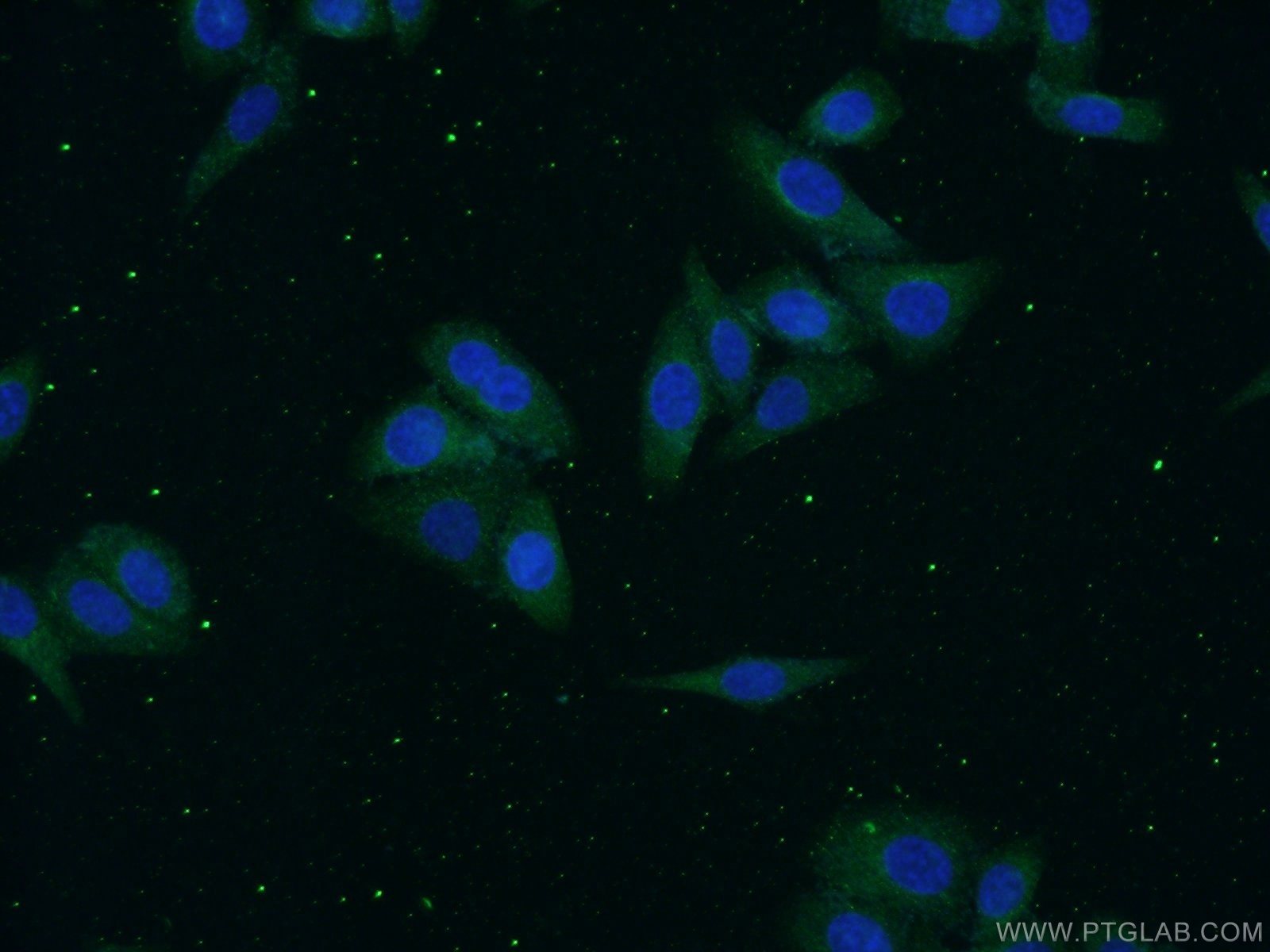 IF Staining of HepG2 using 14181-1-AP