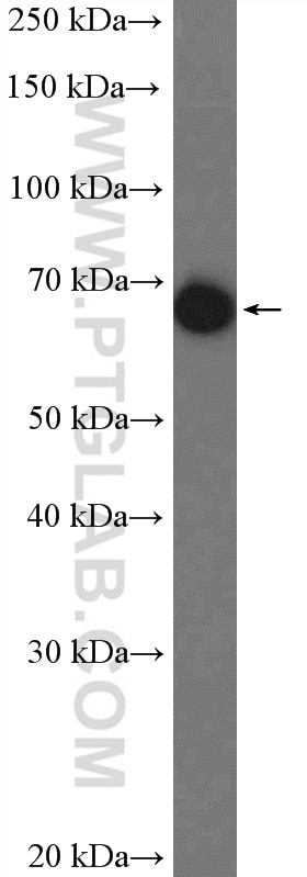 Western Blot (WB) analysis of human plasma using Alpha 1B-Glycoprotein Polyclonal antibody (14181-1-AP)