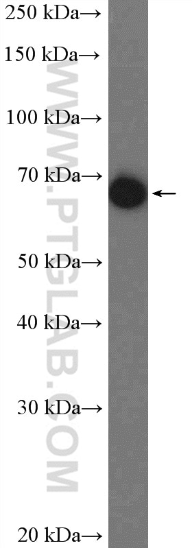 WB analysis of human plasma using 14181-1-AP