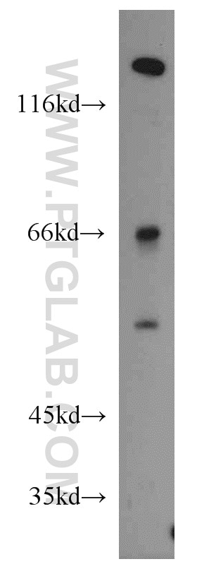 Western Blot (WB) analysis of MCF-7 cells using Alpha 1B-Glycoprotein Polyclonal antibody (14181-1-AP)
