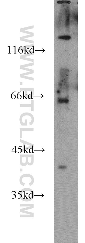 Western Blot (WB) analysis of BxPC-3 cells using Alpha 1B-Glycoprotein Polyclonal antibody (14181-1-AP)