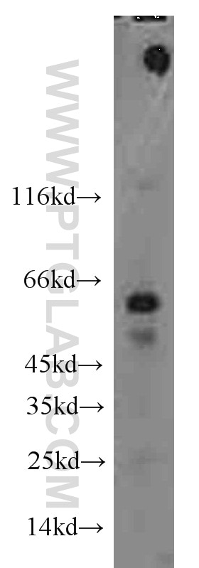 Western Blot (WB) analysis of mouse kidney tissue using Alpha 1B-Glycoprotein Polyclonal antibody (14181-1-AP)