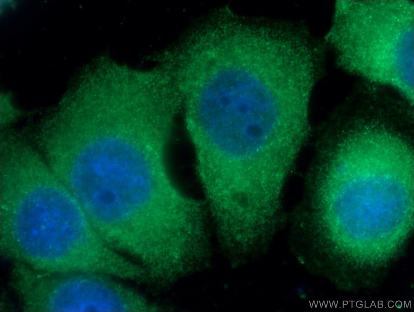Immunofluorescence (IF) / fluorescent staining of HepG2 cells using Alpha 1B-Glycoprotein Monoclonal antibody (66260-1-Ig)