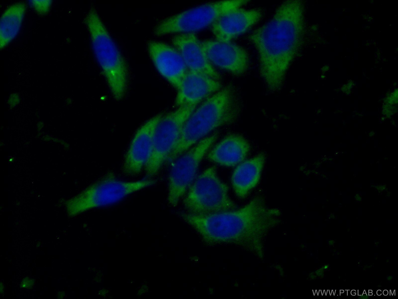 Alpha 1B-Glycoprotein