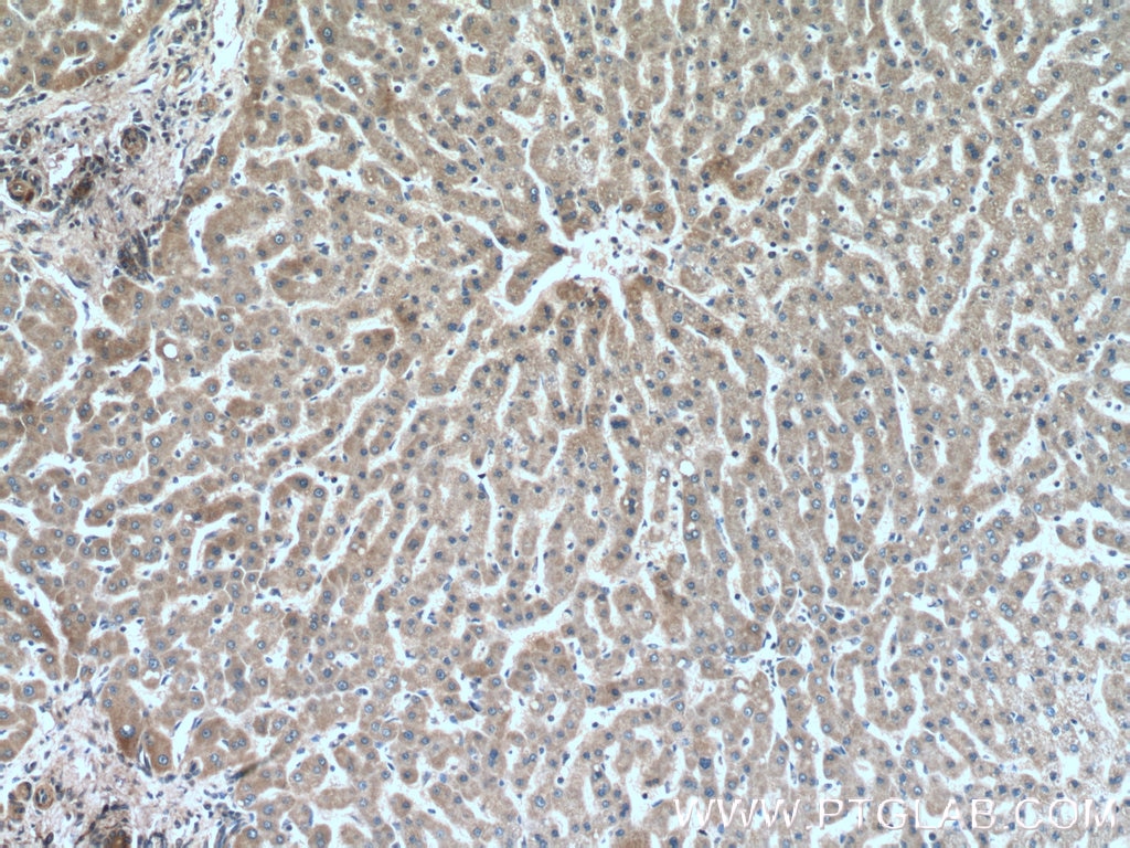 Immunohistochemistry (IHC) staining of human liver tissue using Alpha 1B-Glycoprotein Monoclonal antibody (66260-1-Ig)
