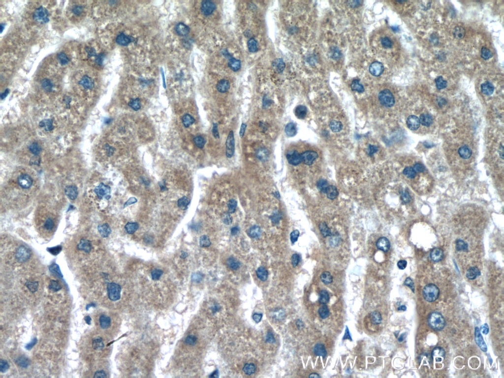 Immunohistochemistry (IHC) staining of human liver tissue using Alpha 1B-Glycoprotein Monoclonal antibody (66260-1-Ig)