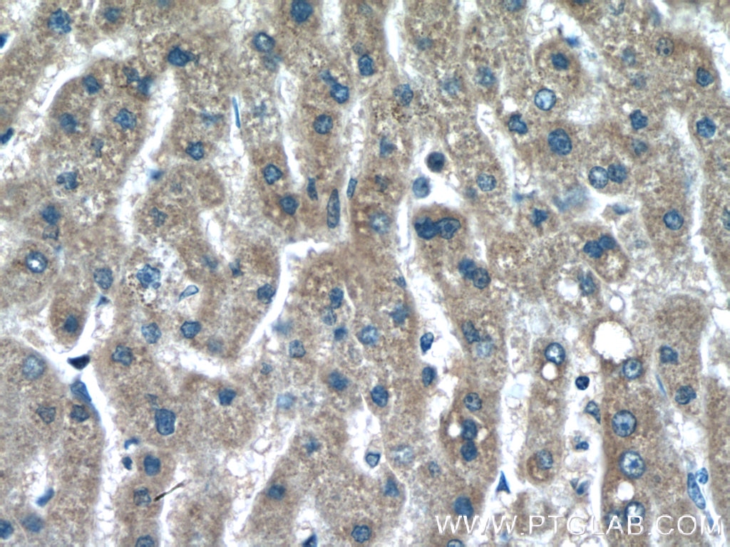 IHC staining of human liver using 66260-1-Ig