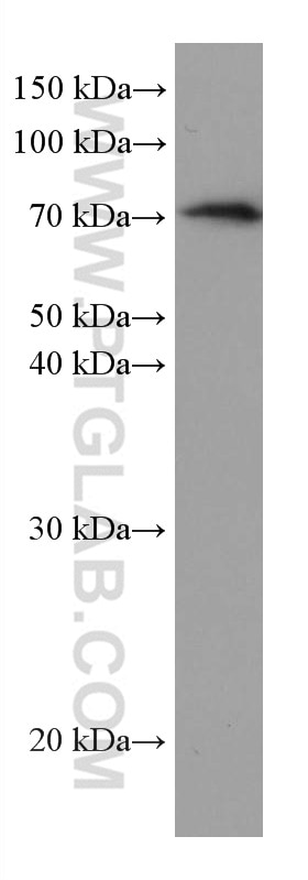 Western Blot (WB) analysis of human placenta tissue using Alpha 1B-Glycoprotein Monoclonal antibody (66260-1-Ig)