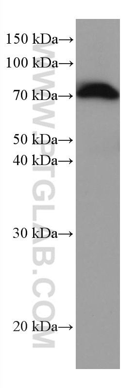Western Blot (WB) analysis of human plasma using Alpha 1B-Glycoprotein Monoclonal antibody (66260-1-Ig)
