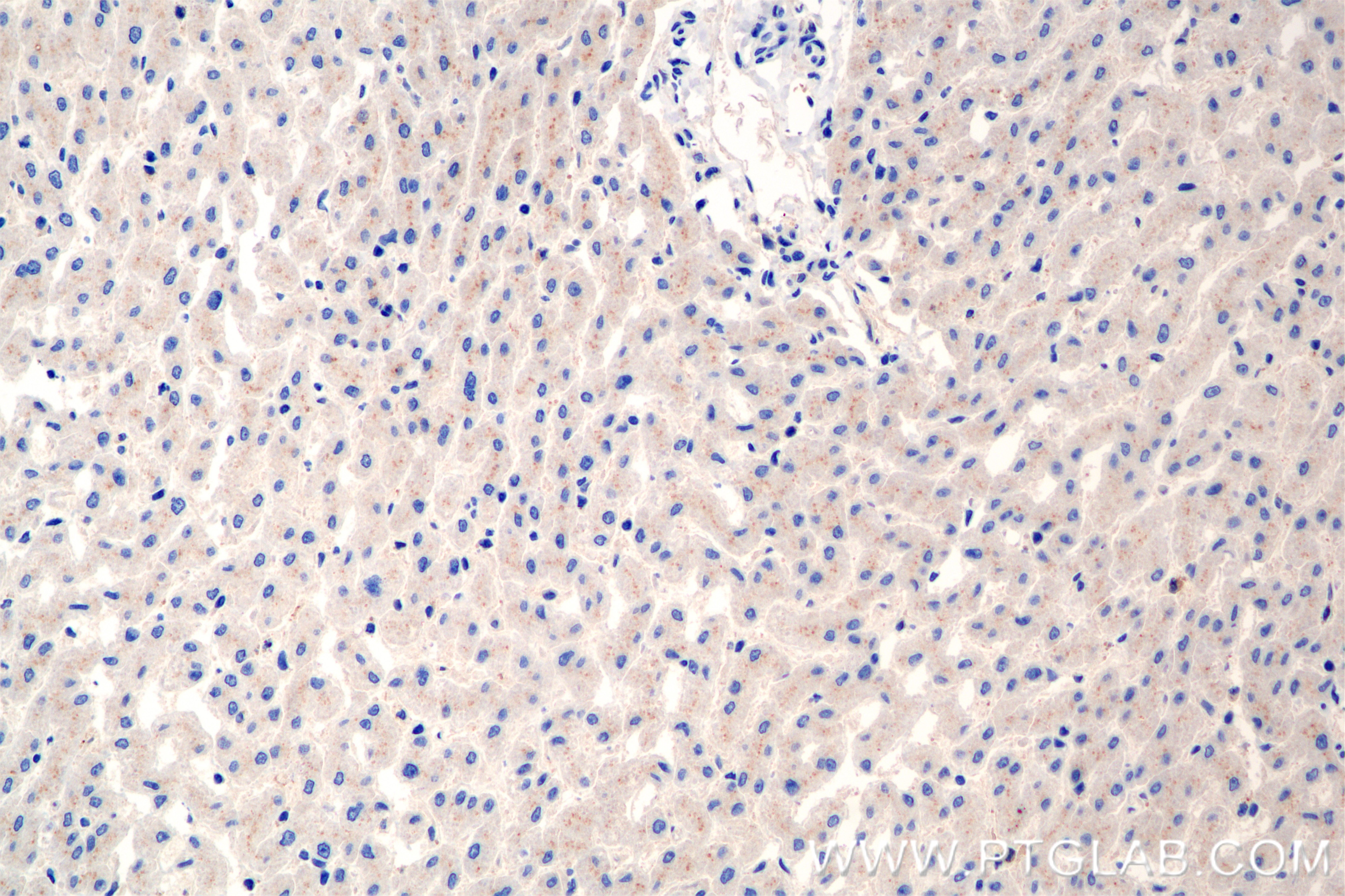 Immunohistochemistry (IHC) staining of human liver tissue using Alpha 1B-Glycoprotein Recombinant antibody (86112-1-RR)