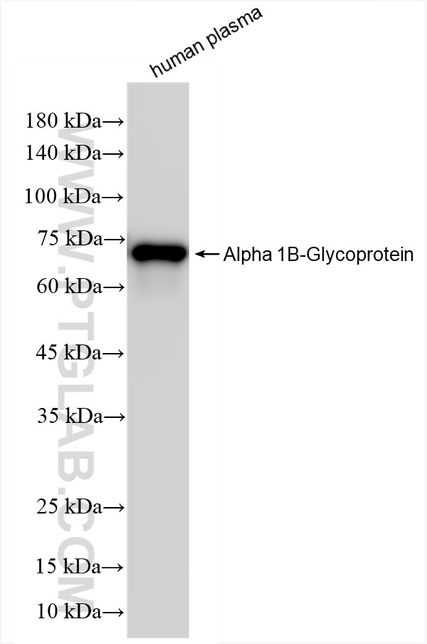 Alpha 1B-Glycoprotein