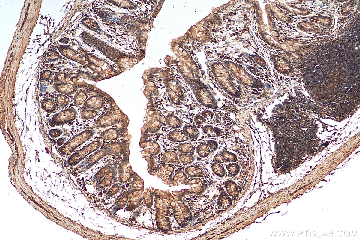 Immunohistochemistry (IHC) staining of mouse colon tissue using A1CF Polyclonal antibody (25812-1-AP)