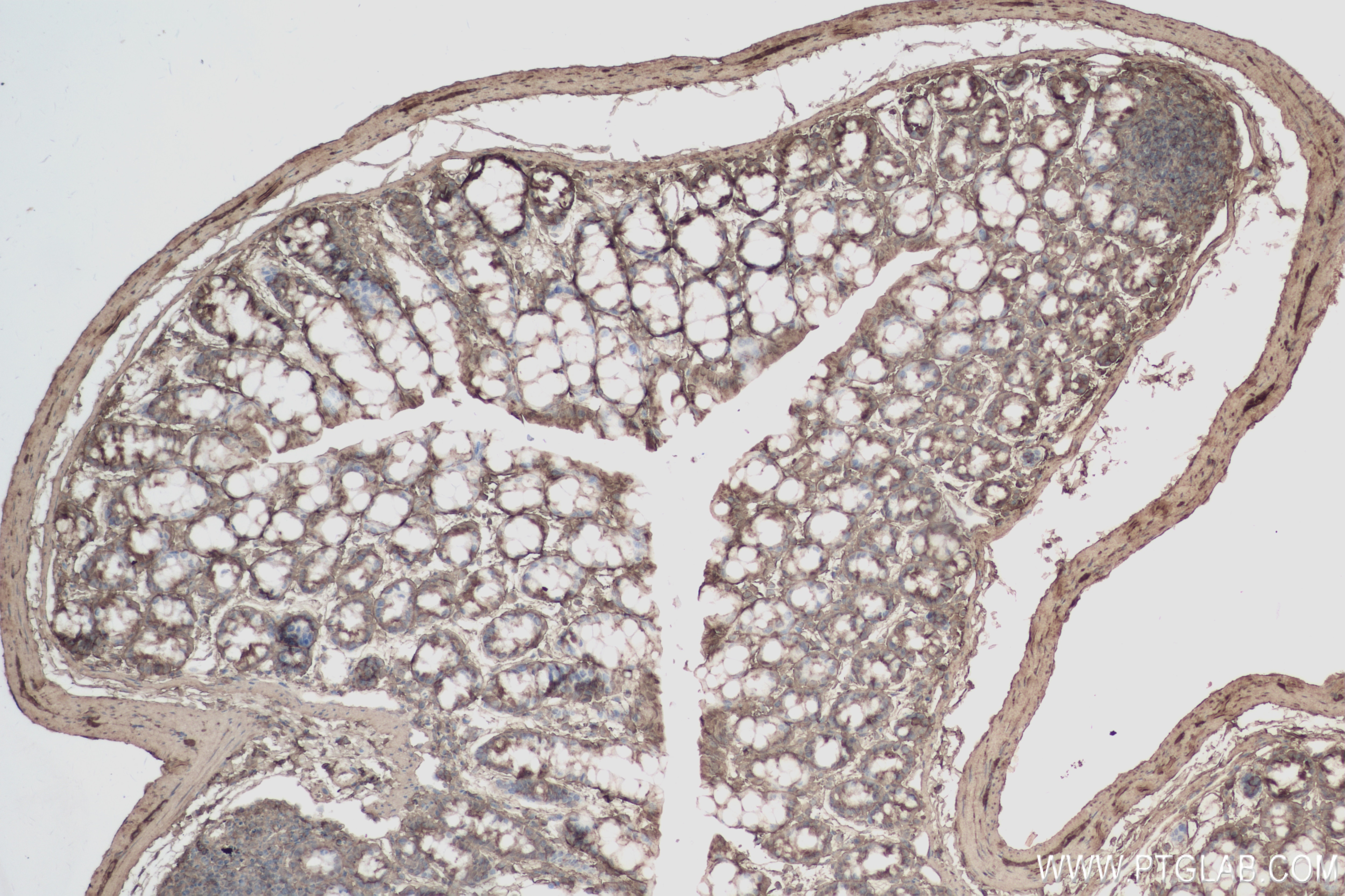 Immunohistochemistry (IHC) staining of mouse colon tissue using A1CF Recombinant antibody (84322-4-RR)