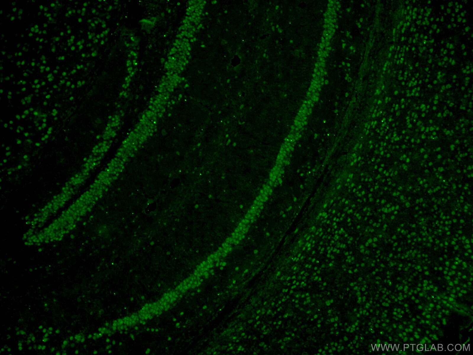 IF Staining of mouse brain using 22647-1-AP