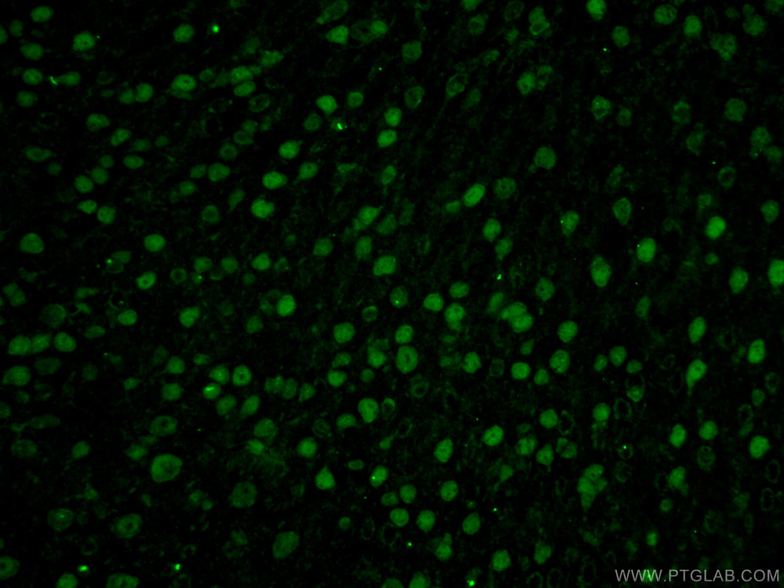 Immunofluorescence (IF) / fluorescent staining of mouse brain tissue using A2BP1 Polyclonal antibody (22647-1-AP)