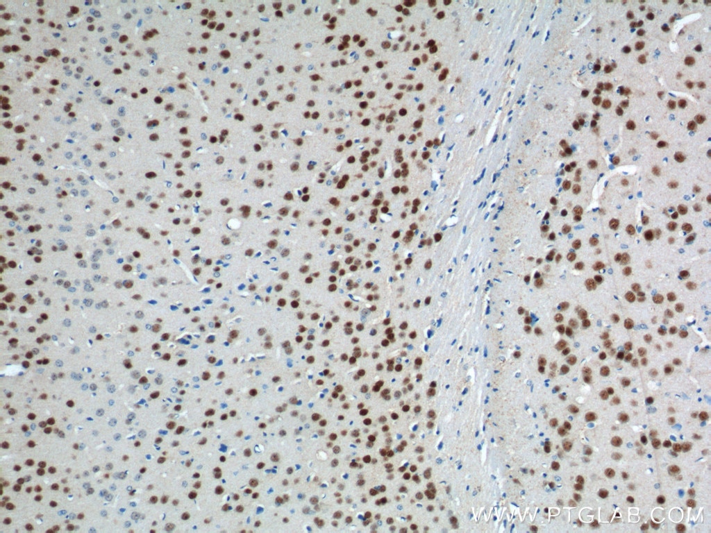 Immunohistochemistry (IHC) staining of mouse brain tissue using A2BP1 Polyclonal antibody (22647-1-AP)