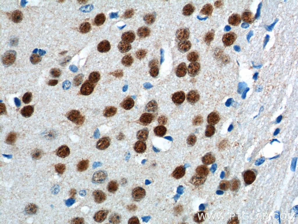 IHC staining of mouse brain using 22647-1-AP